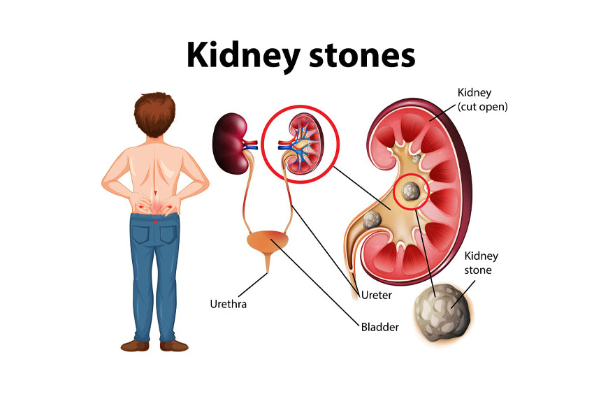 CBD e insuficiencia renal: todo lo que debes saber