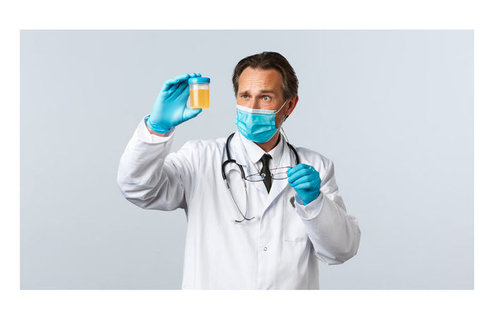 CBD y análisis de orina: ¿hay riesgo de dar positivo?